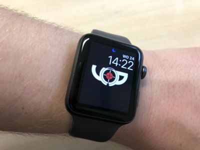 YOP online om arm Apple Watch